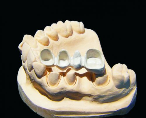 Materiał termoplastyczny na protezy zębowe Bio Strong 25 mm