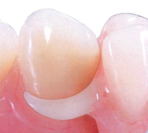 Materiał termoplastyczny na protezy zębowe Flexi Acetal 25 mm